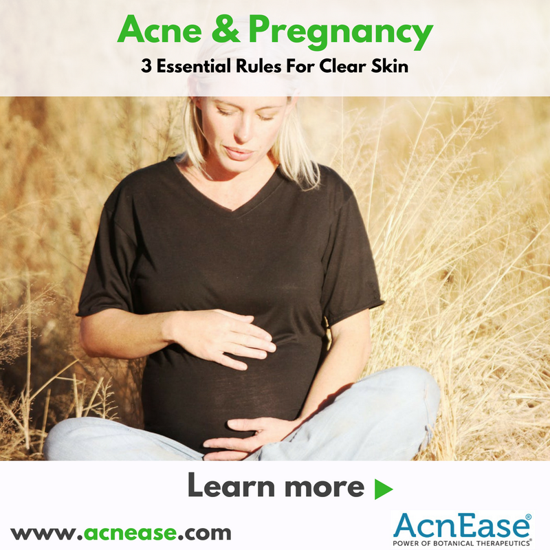 Acne During Pregnancy Boy Or Girl