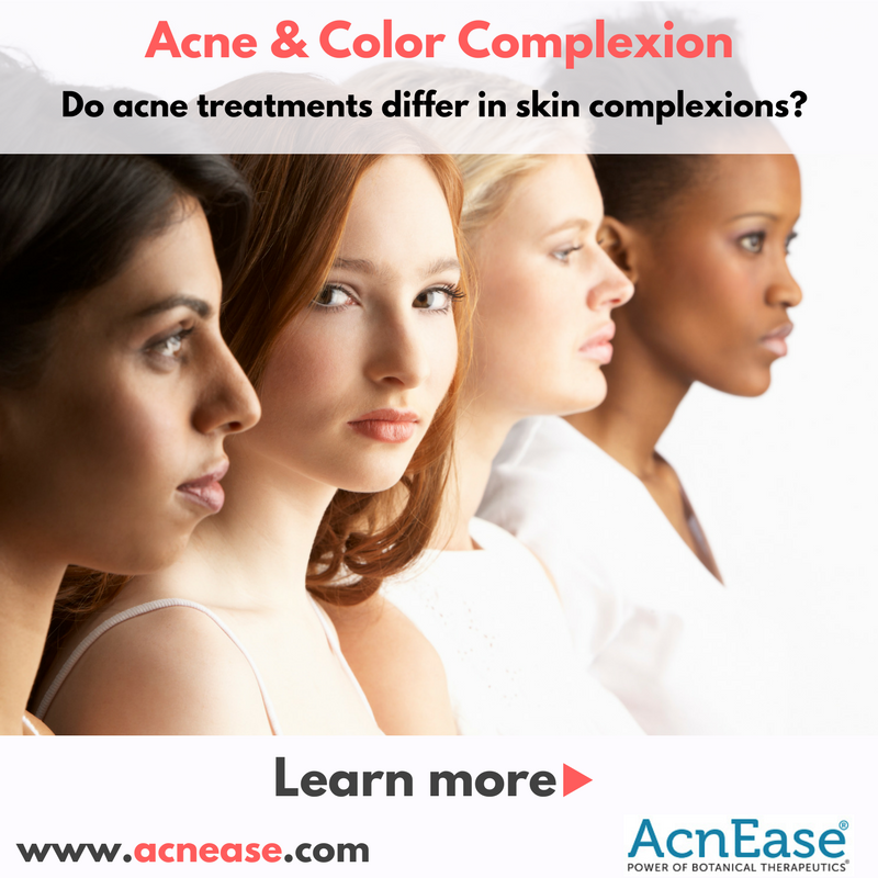 Is acne treatment different for different color complexion? | Blog