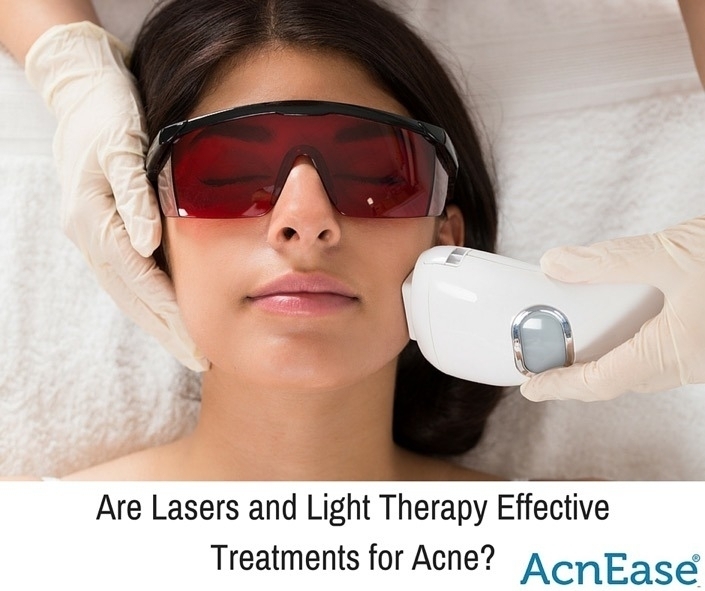 Are Lasers and Light Therapy Effective Treatments for Acne? Blog