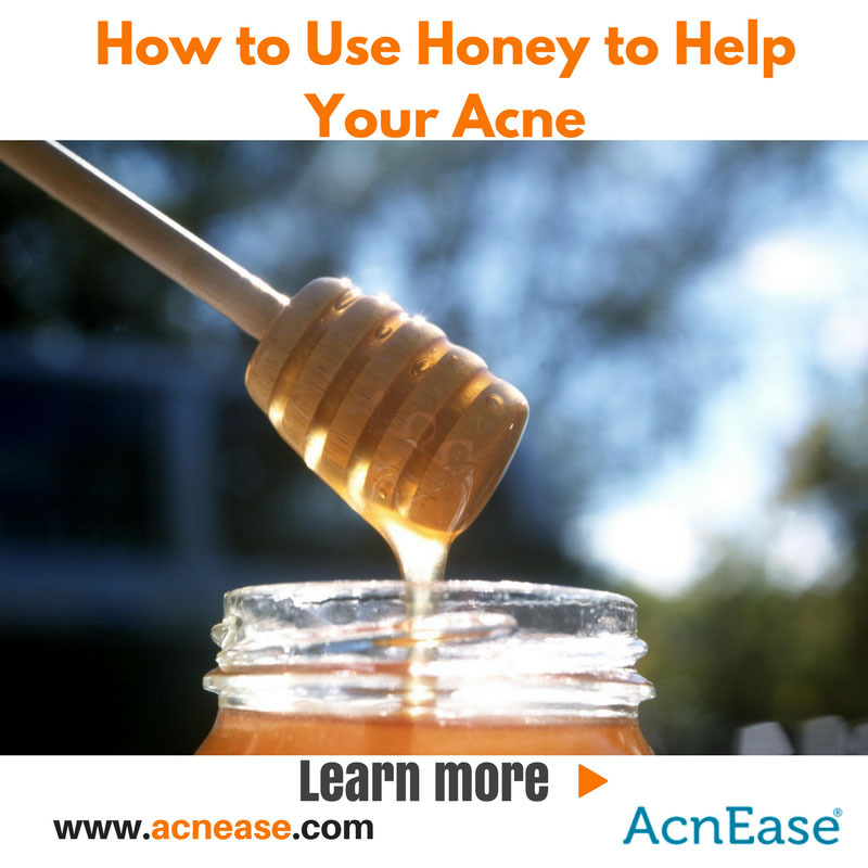 The Benefits Of Using Honey To Help Your Acne From The Inside Out Blog